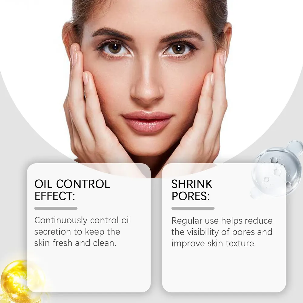 Witch Hazel Oil-Control Face Cream