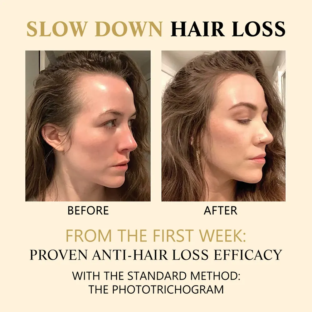 Ginseng Scalp Roll-On Essence
