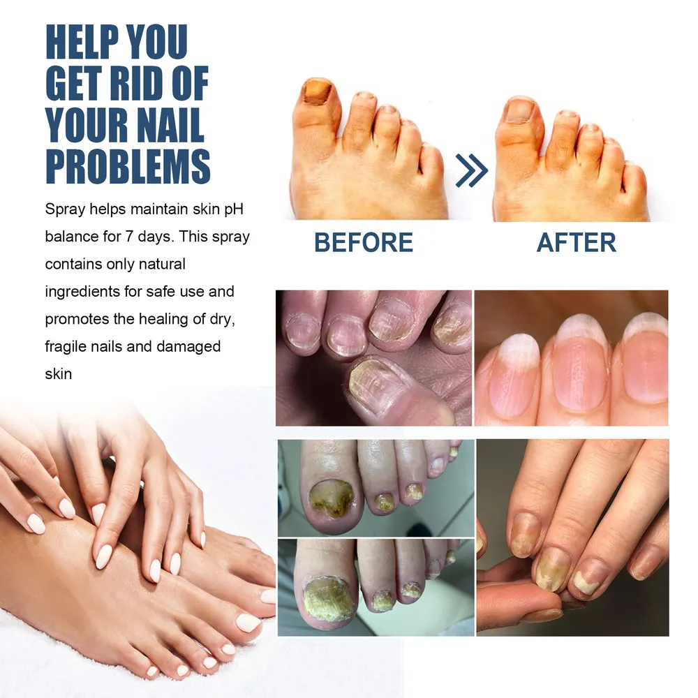 Refreshing Nail Care Spray