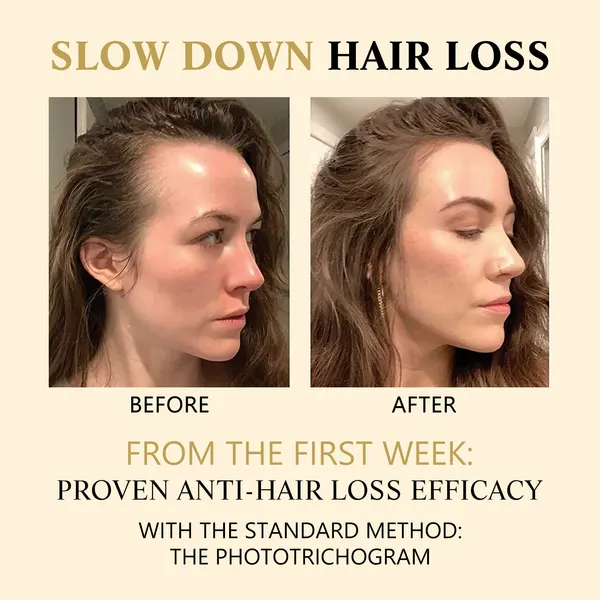 Ginseng Scalp Roll-On Essence