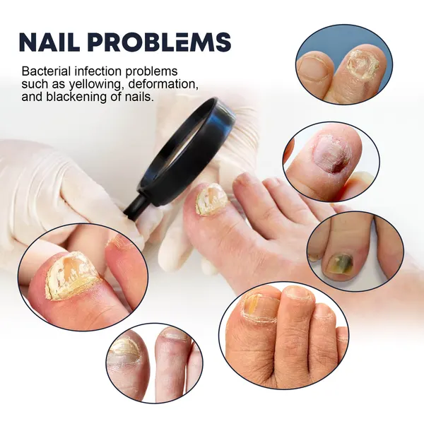 Nail Hydration Oil Spray